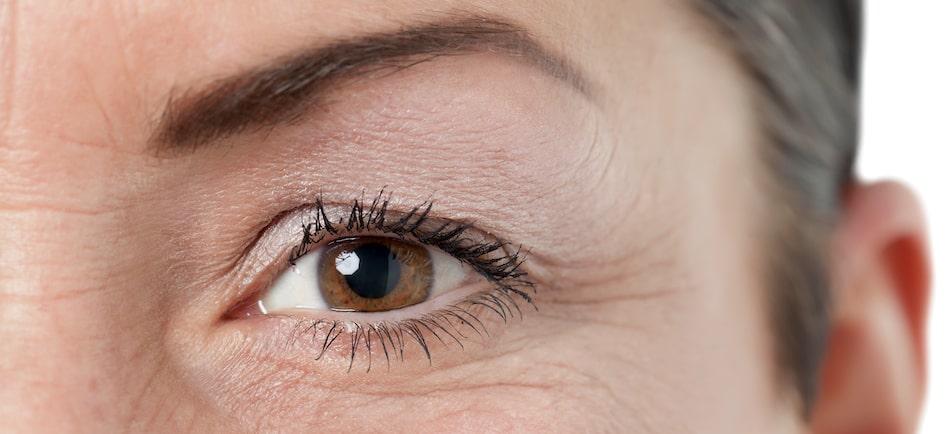 Eyelid surgery rising popularity