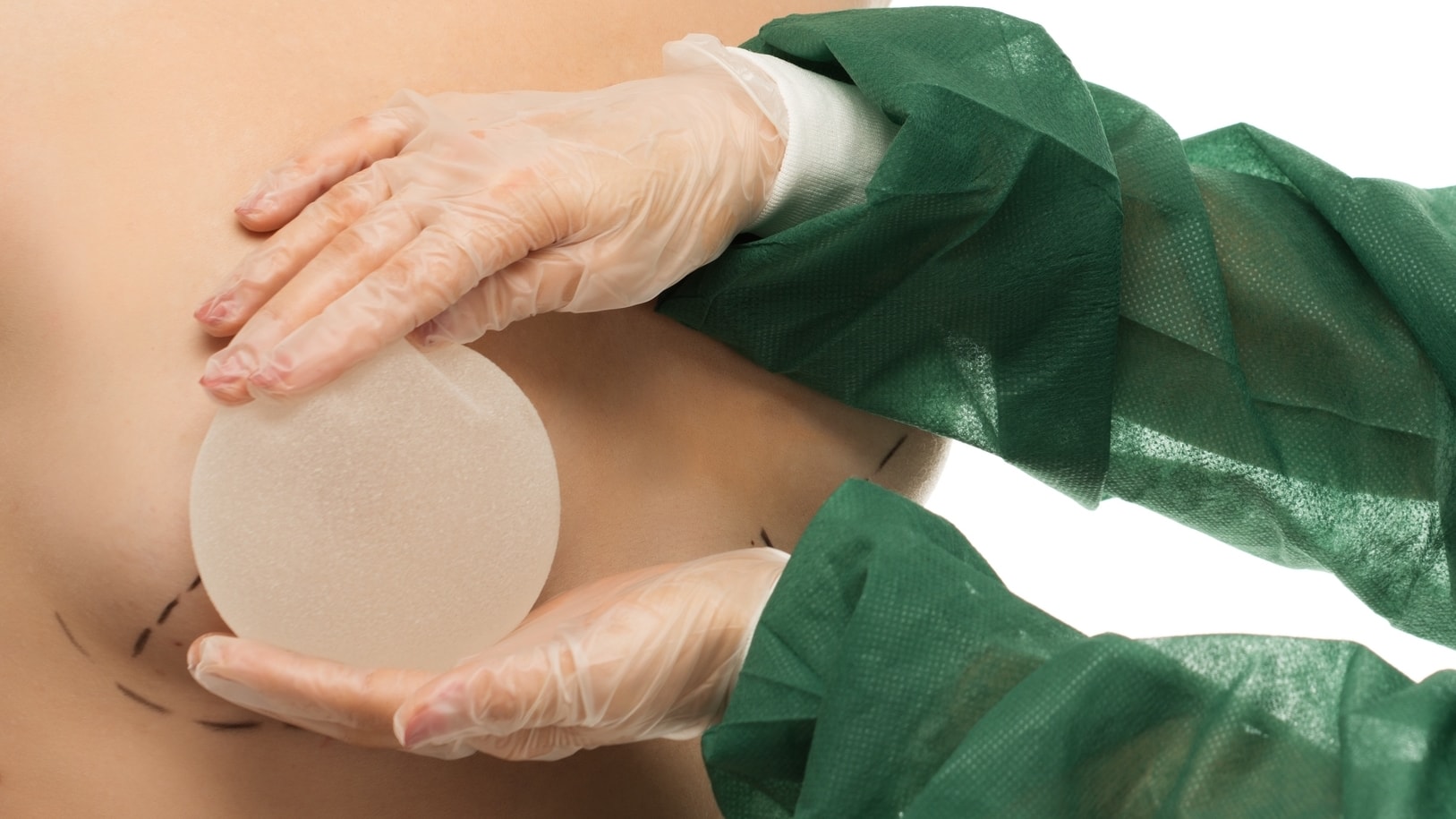 как делают пластическую операцию груди женщин фото 64