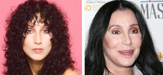 Discover Examples Of Celebrity Plastic Surgery Gone Wrong Cosmetic Town