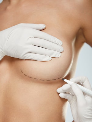 What Is “Drop and Fluff” After Breast Augmentation?